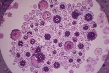 Bild zu einem Artikel über Darmgesundheit